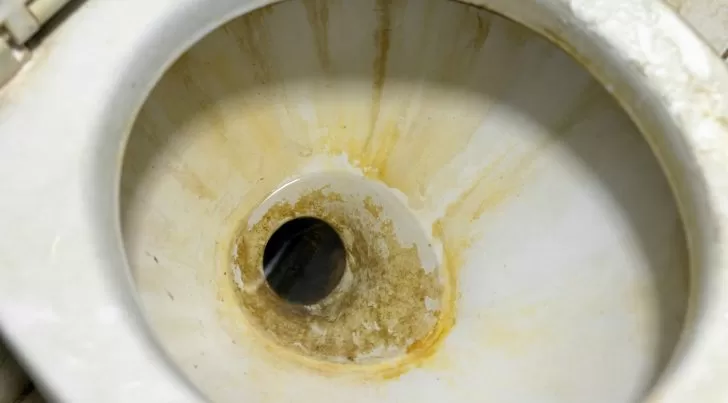Ani ocet, ani jedlá soda: nejlepší způsob, jak odstranit vodní kámen z kohoutků a toalet.